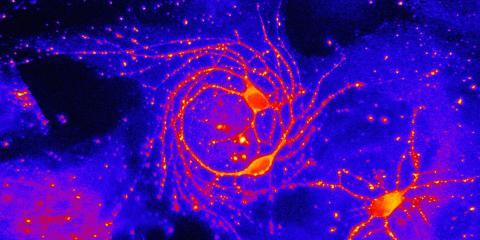 Concorso fotografico “Arte o scienza?”-BajGabriele_NeuronsInLove_ArteOScienza2010-Gabriele Baj: Neurons In Love, Arte o Scienza 2010