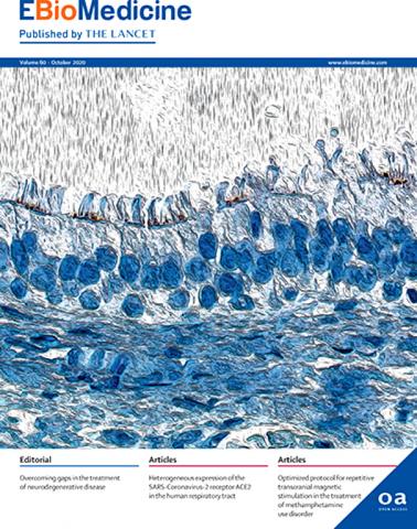 Su Lancet studio su danno polmonare da COVID-19 a prima firma di Rossana Bussani di UniTs-EBIO medicine img-