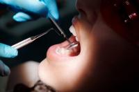 Il tartaro dentale “memorizza” il Covid 19: UniTs  descrive per la prima volta un nuovo sistema di rilevazione del virus-Odonto img-